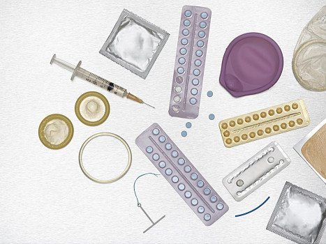 10 вопросов, которые должна учитывать каждая женщина при выборе контрацепции