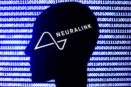 Neuralink от Elon Musk готовится к человеческому исследованию мозговой чипы с ключевыми наймами